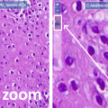 zoom3.png