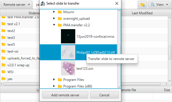 transfer_slide_remote_server_tree.png